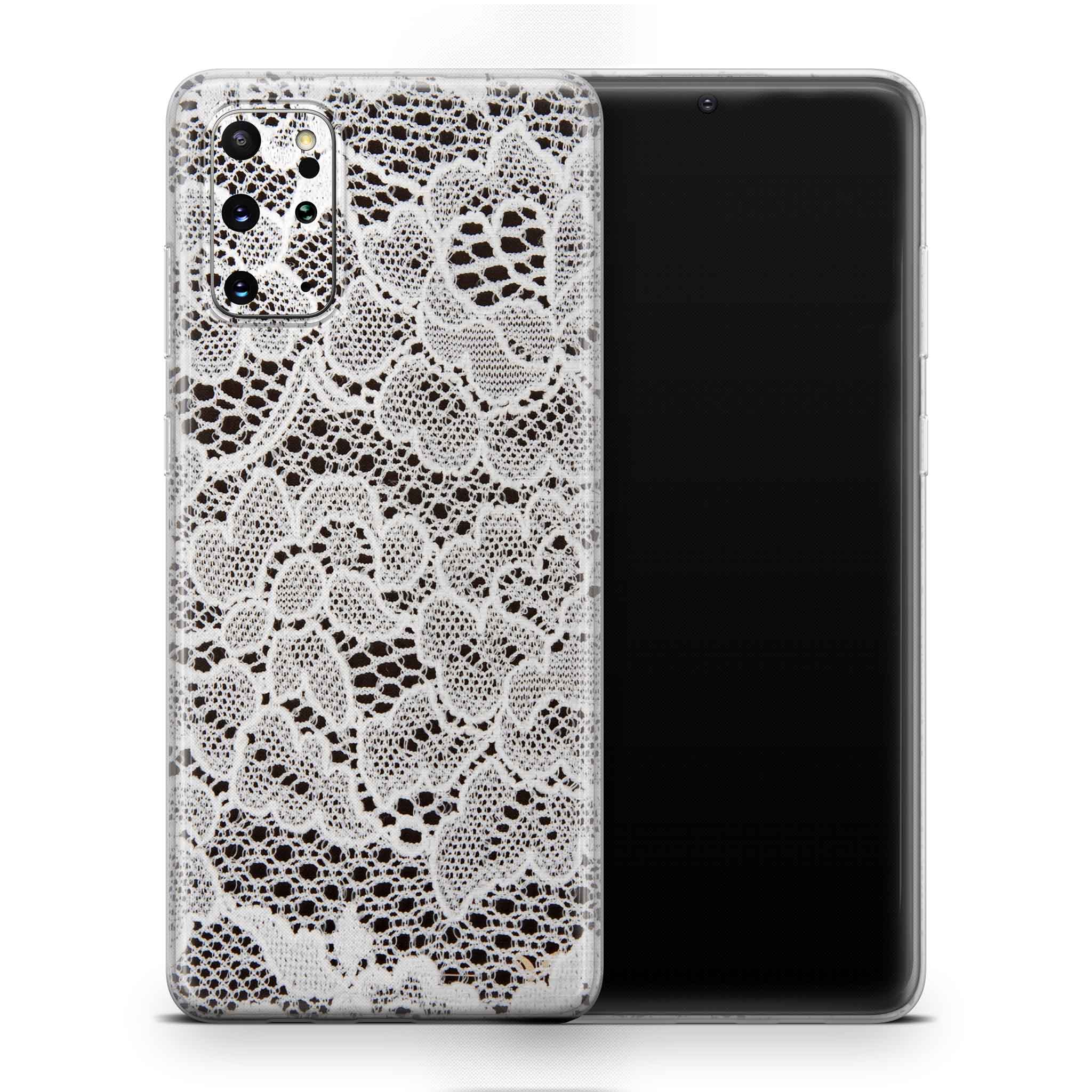 French Lace Samsung Galaxy Skin + Case