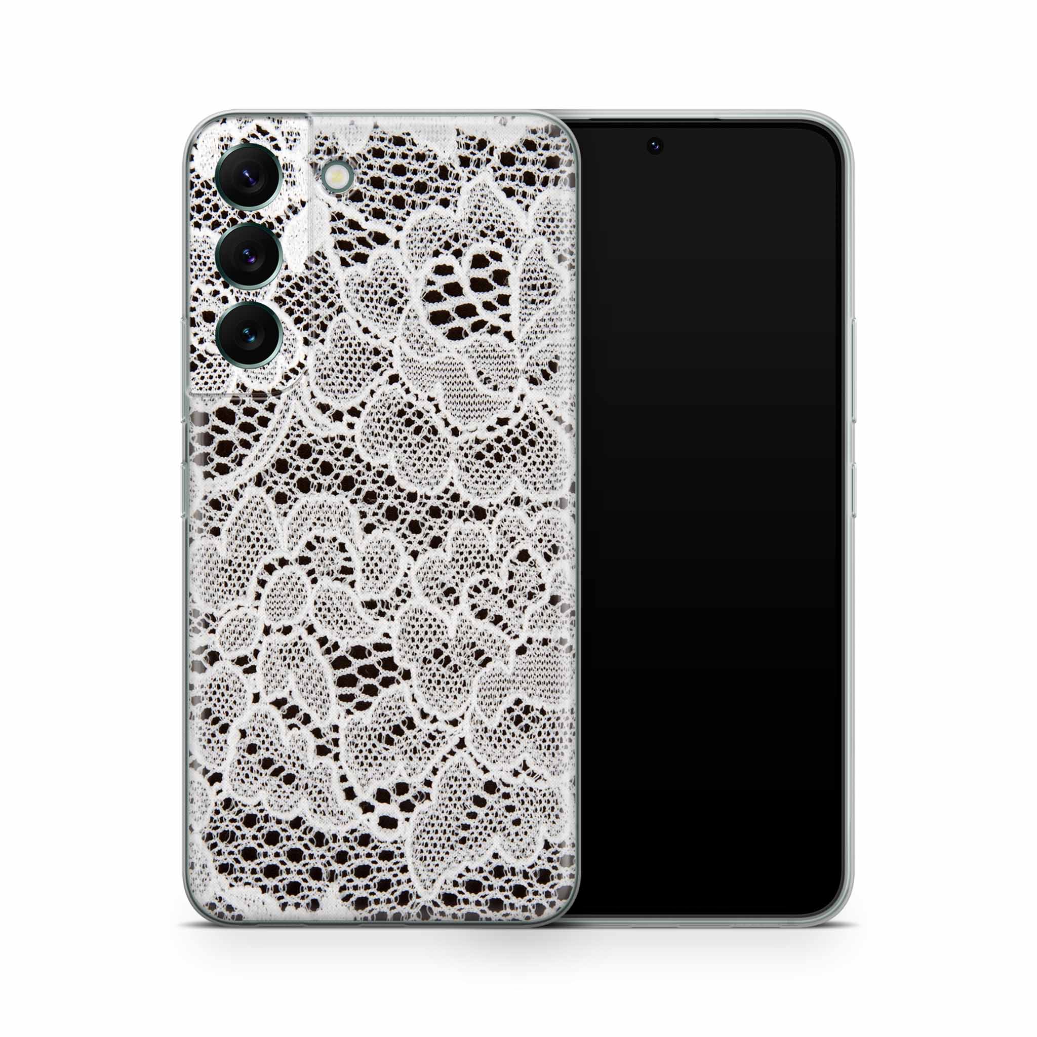 French Lace Samsung Galaxy Skin + Case