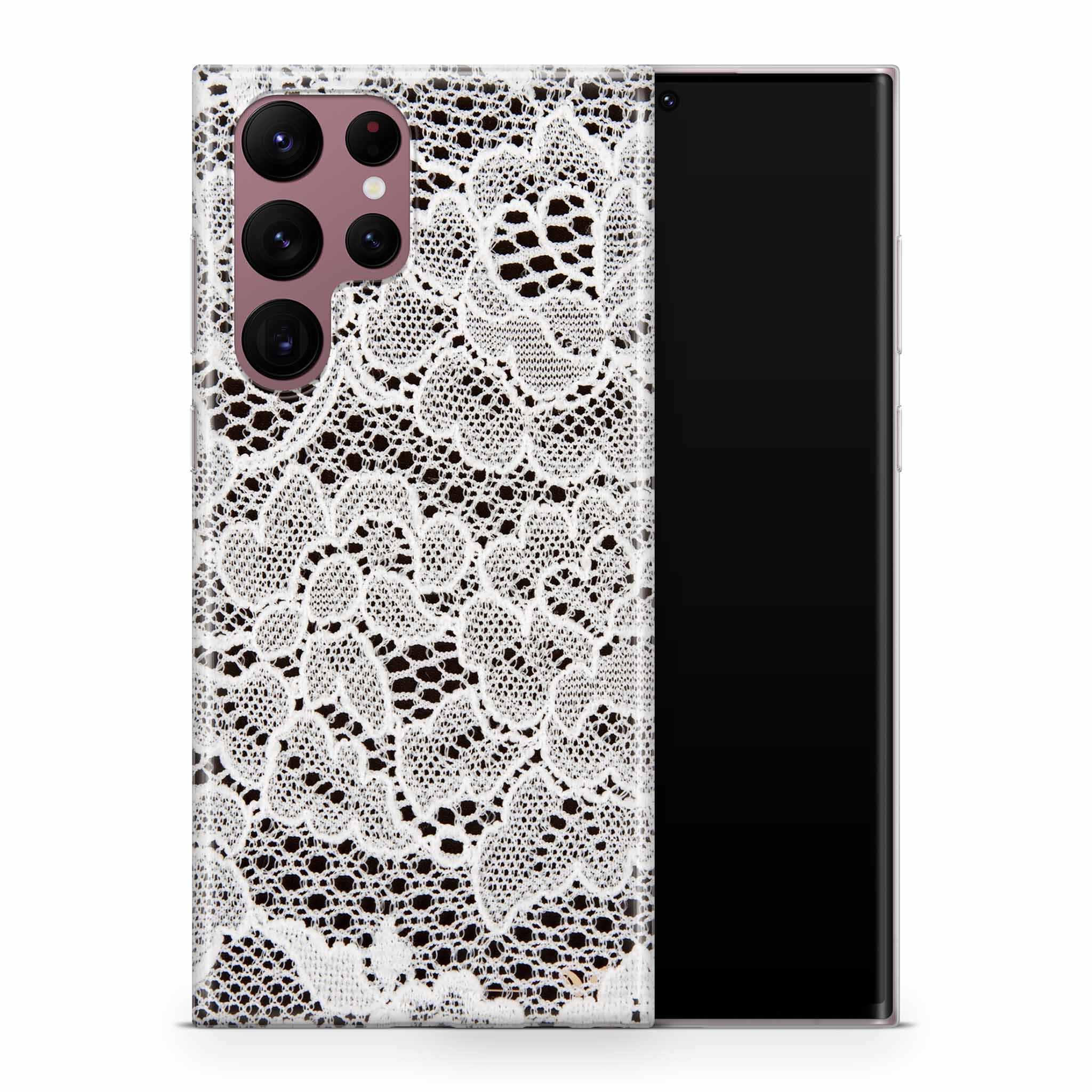 French Lace Samsung Galaxy Skin + Case