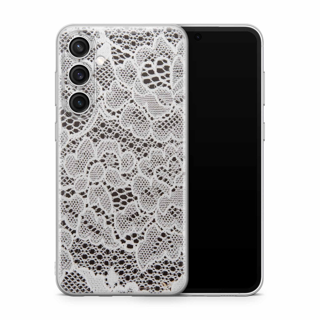 French Lace Samsung Galaxy Skin + Case