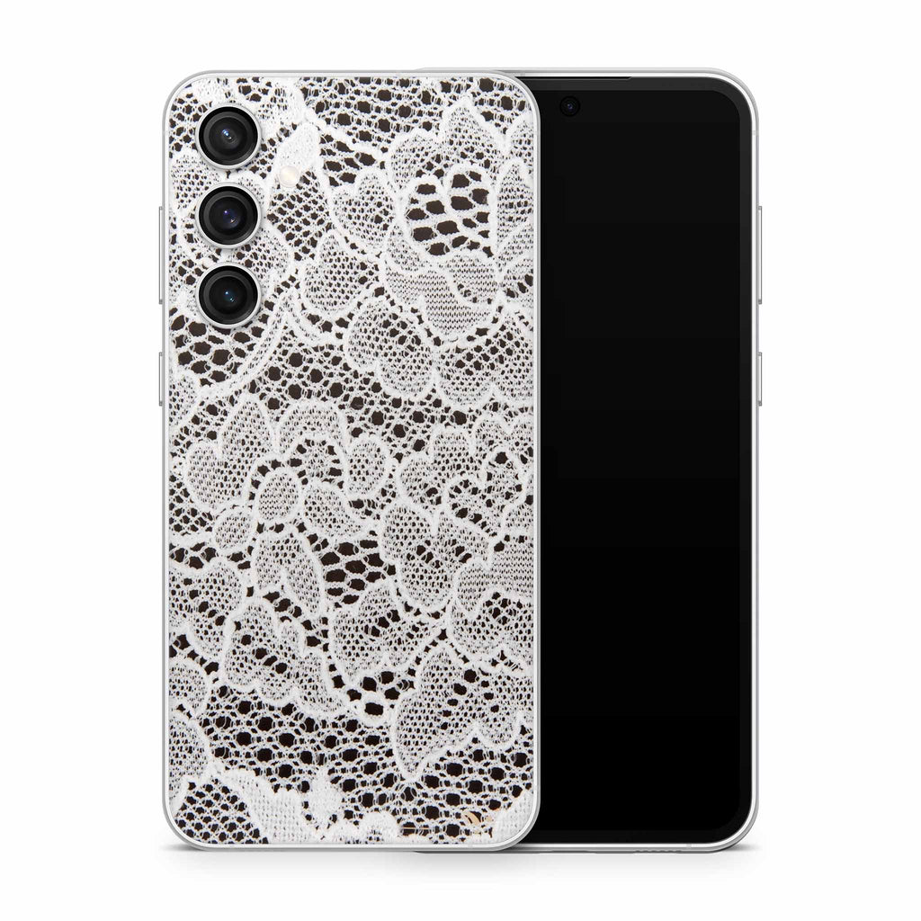 French Lace Samsung Galaxy Skin + Case