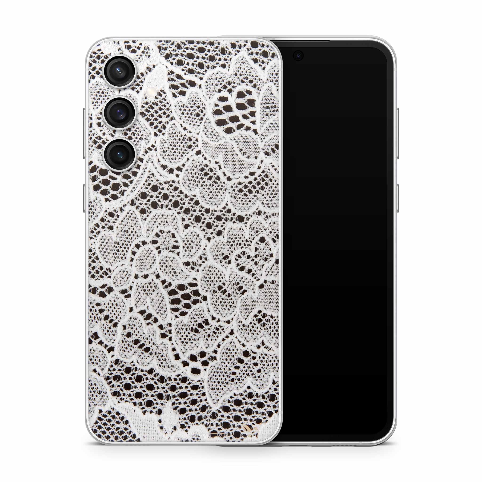 French Lace Samsung Galaxy Skin + Case