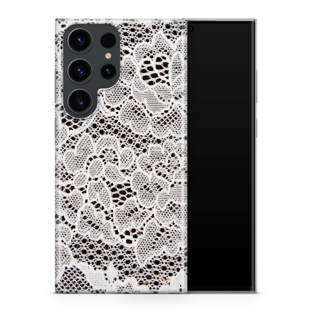 French Lace Samsung Galaxy Skin + Case