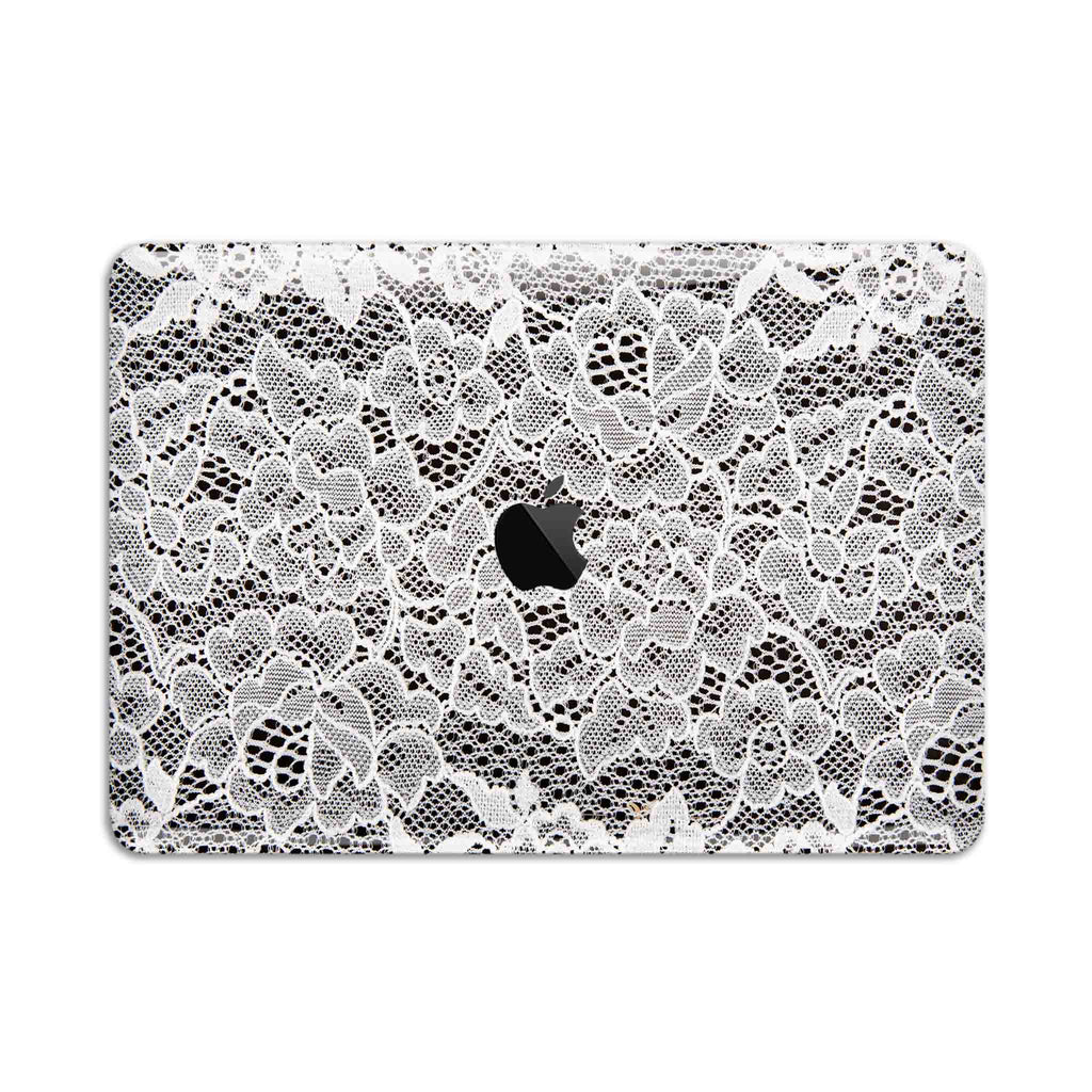 French Lace MacBook Skin + Case