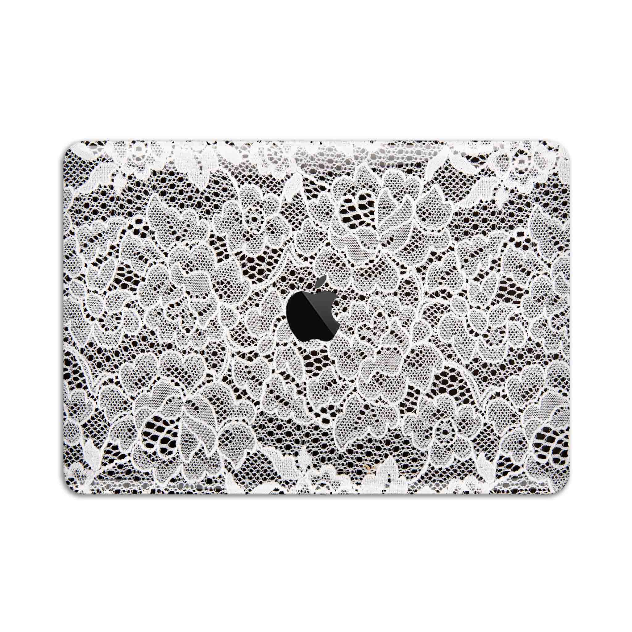 French Lace MacBook Skin + Case