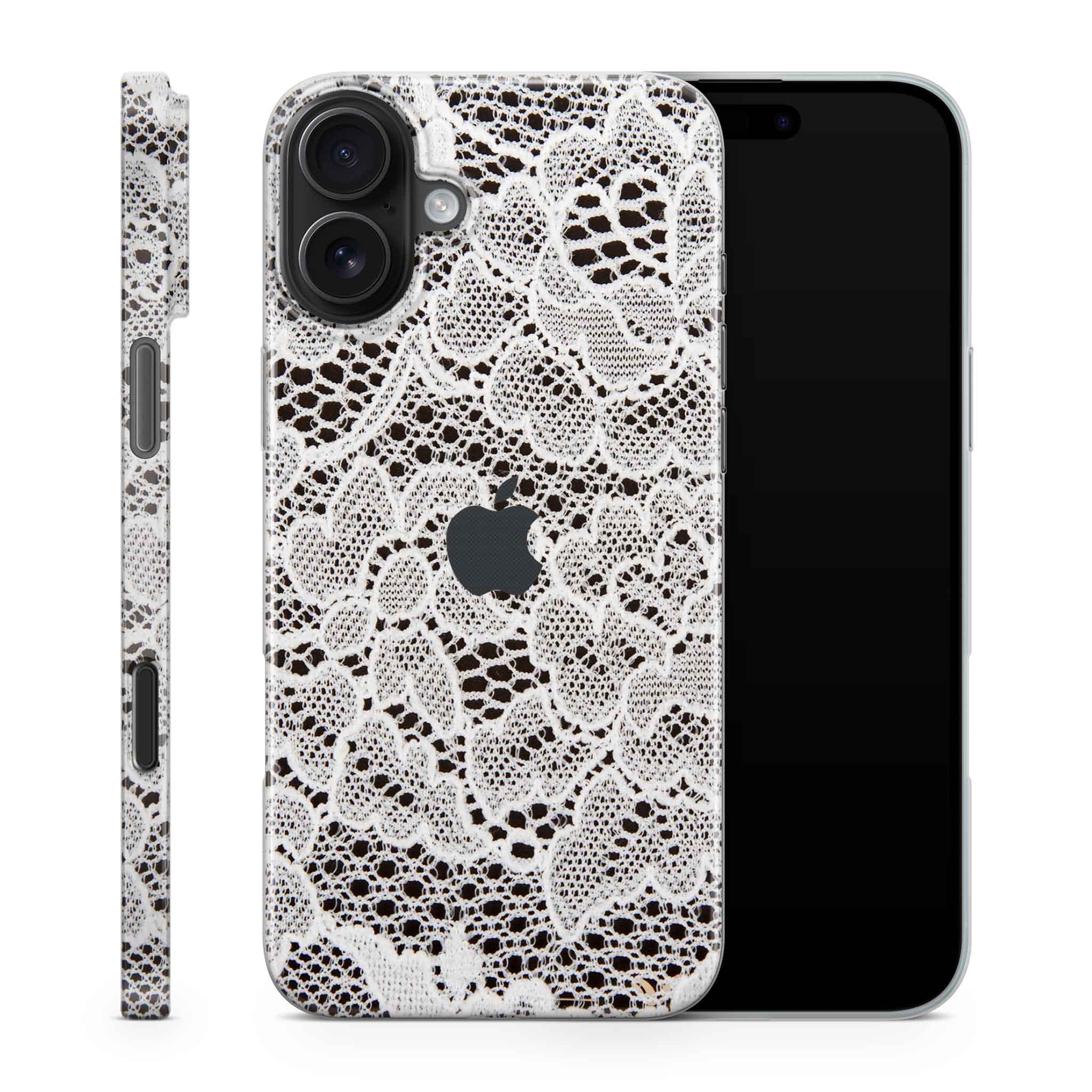 French Lace iPhone Skin + Case