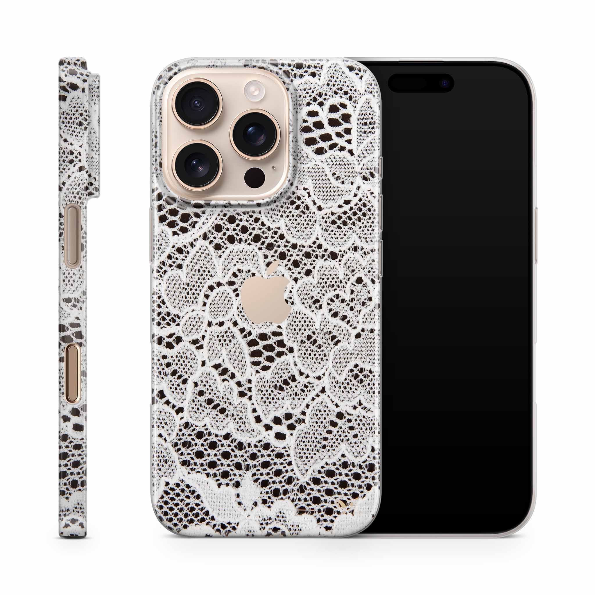 French Lace iPhone Skin + Case