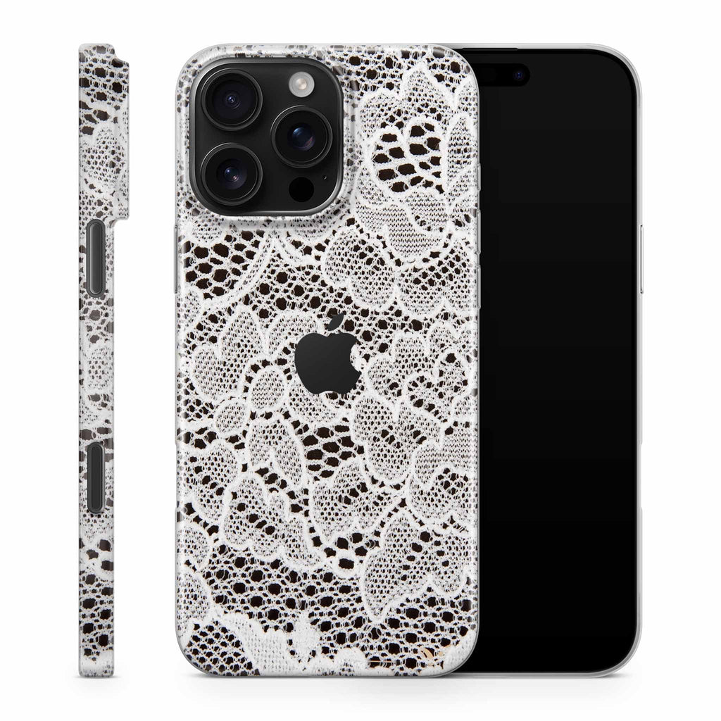 French Lace iPhone Skin + Case