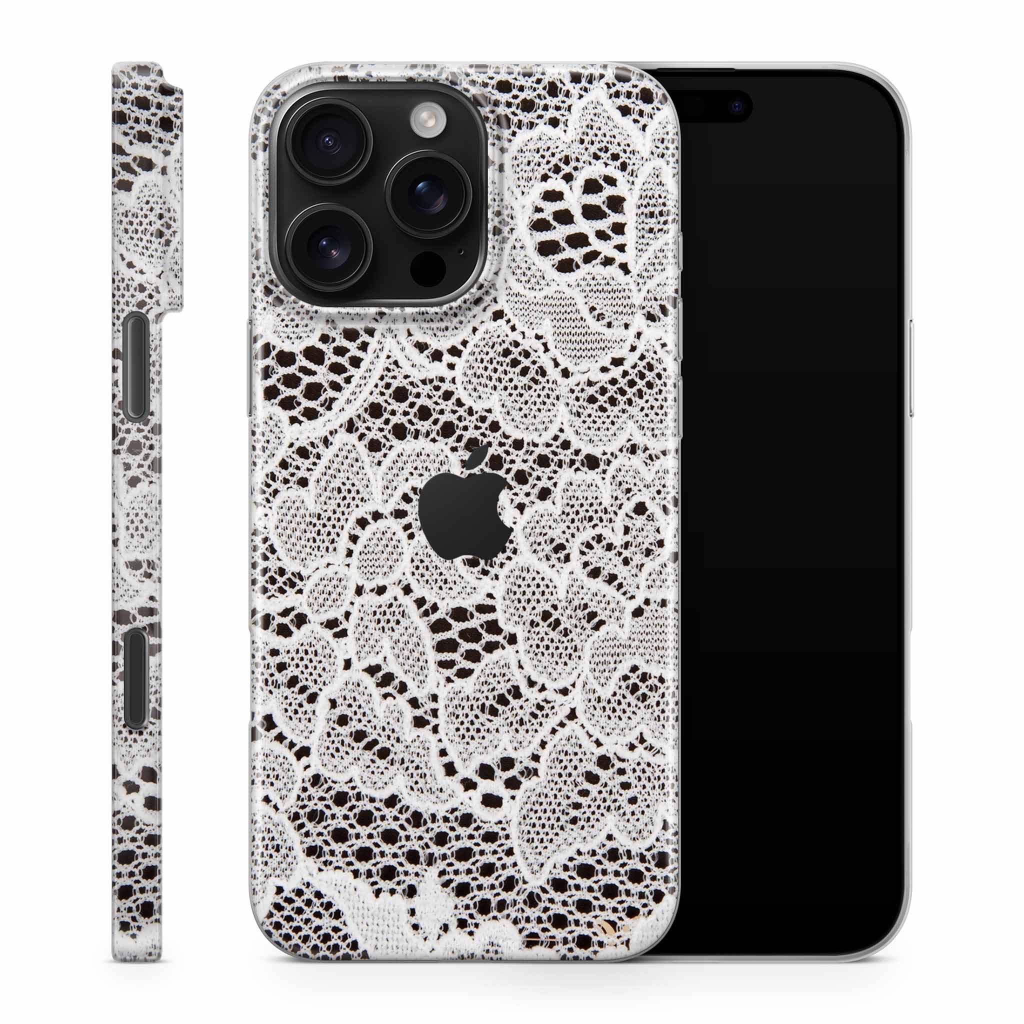 French Lace iPhone Skin + Case