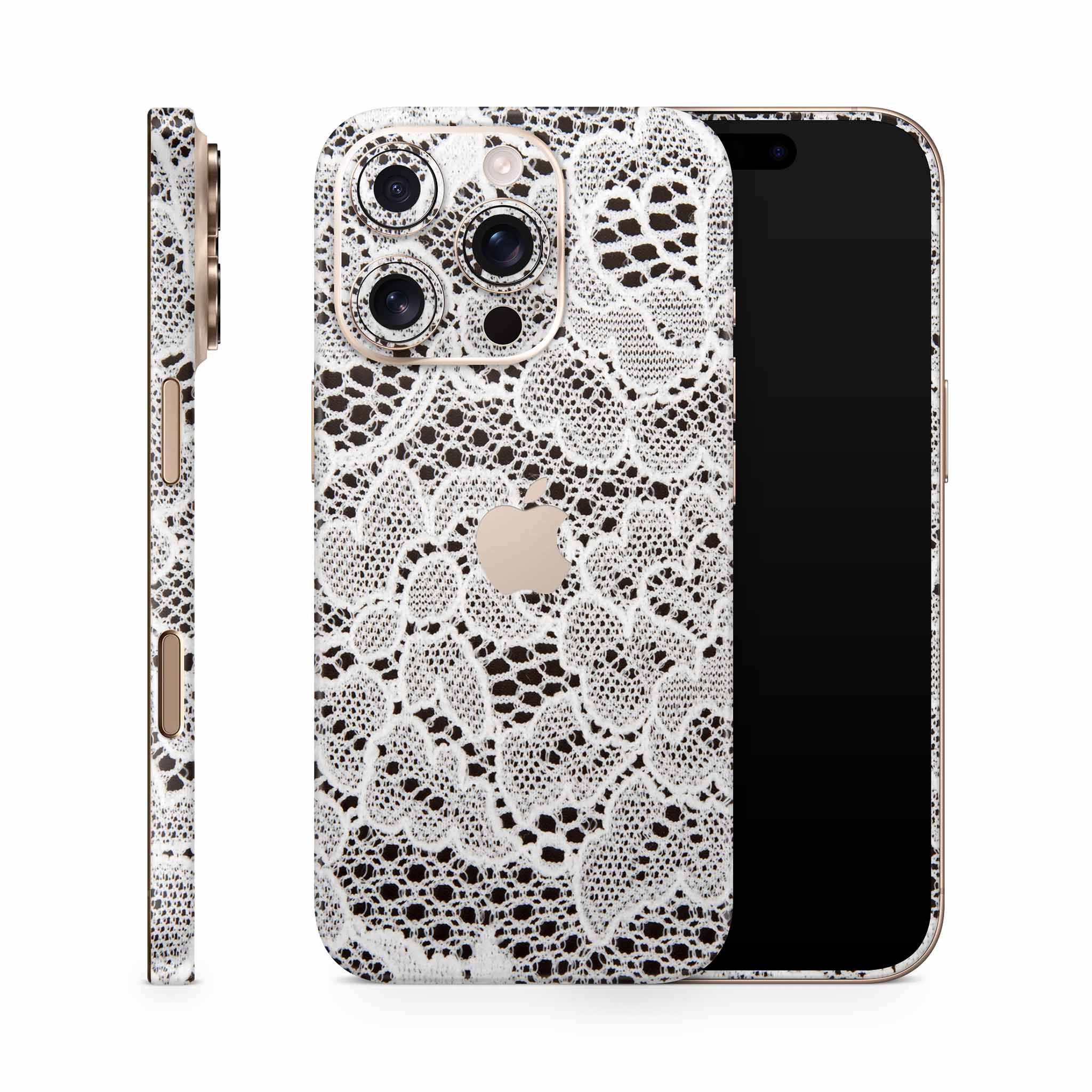 French Lace iPhone Skin + Case