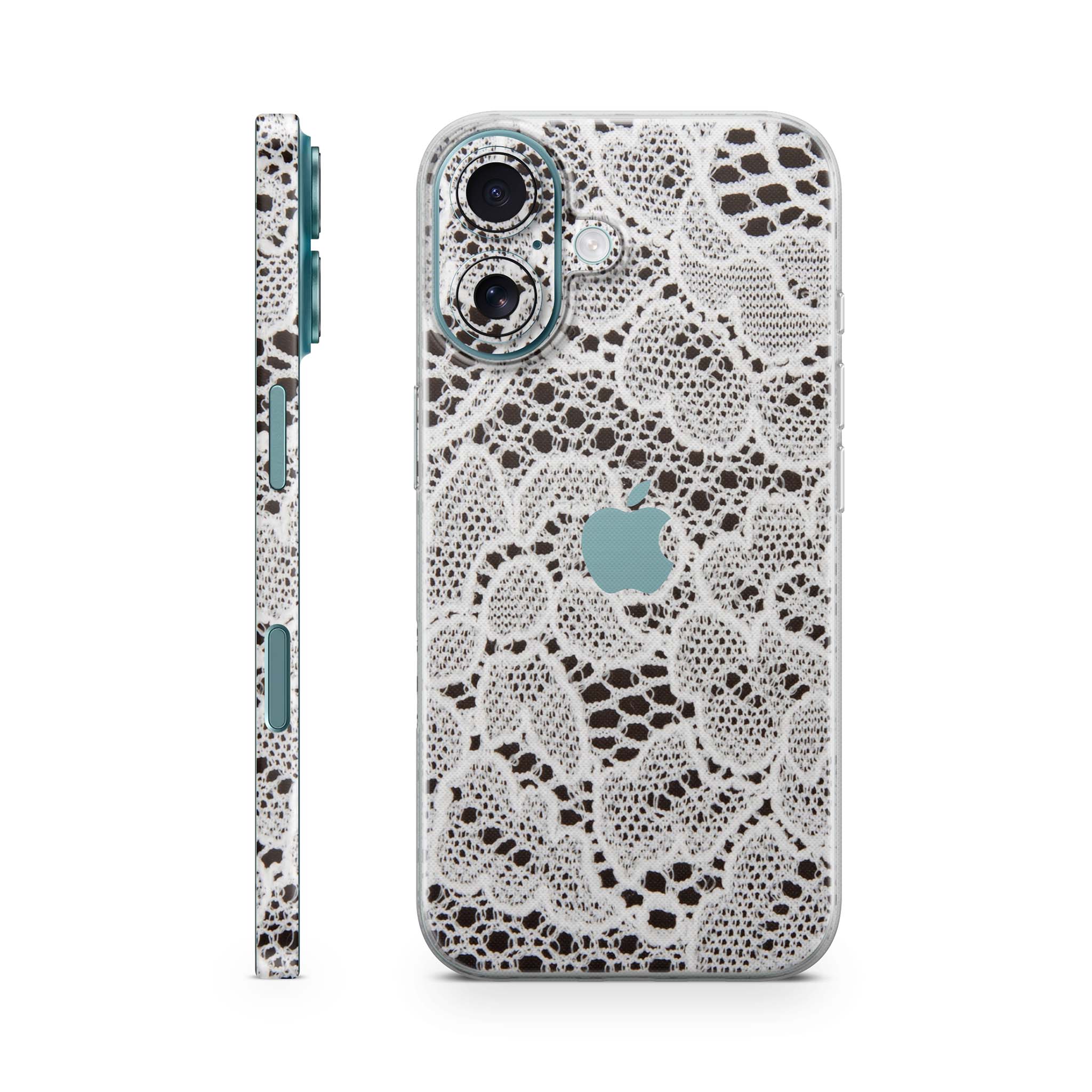 French Lace iPhone Skin + Case