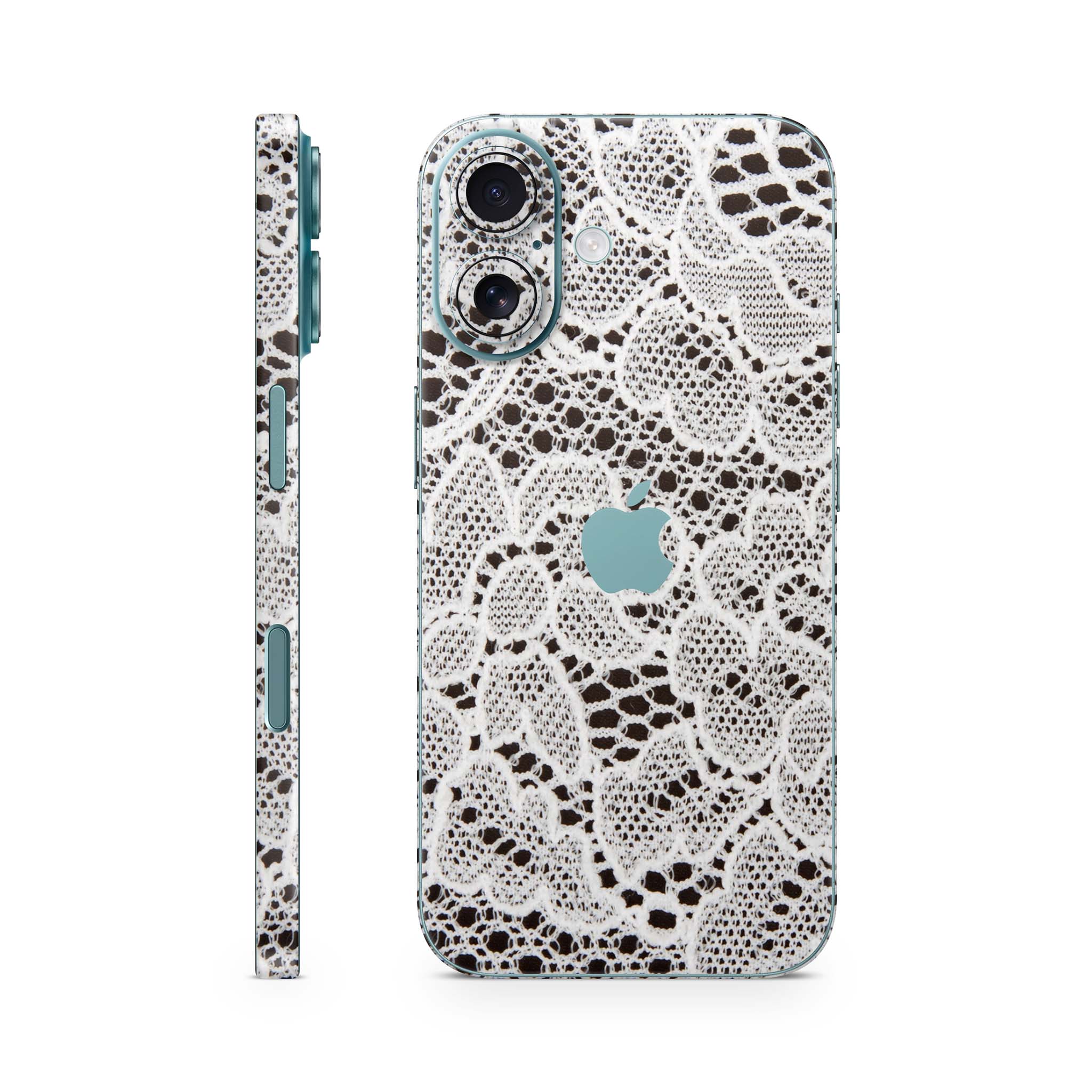 French Lace iPhone Skin + Case