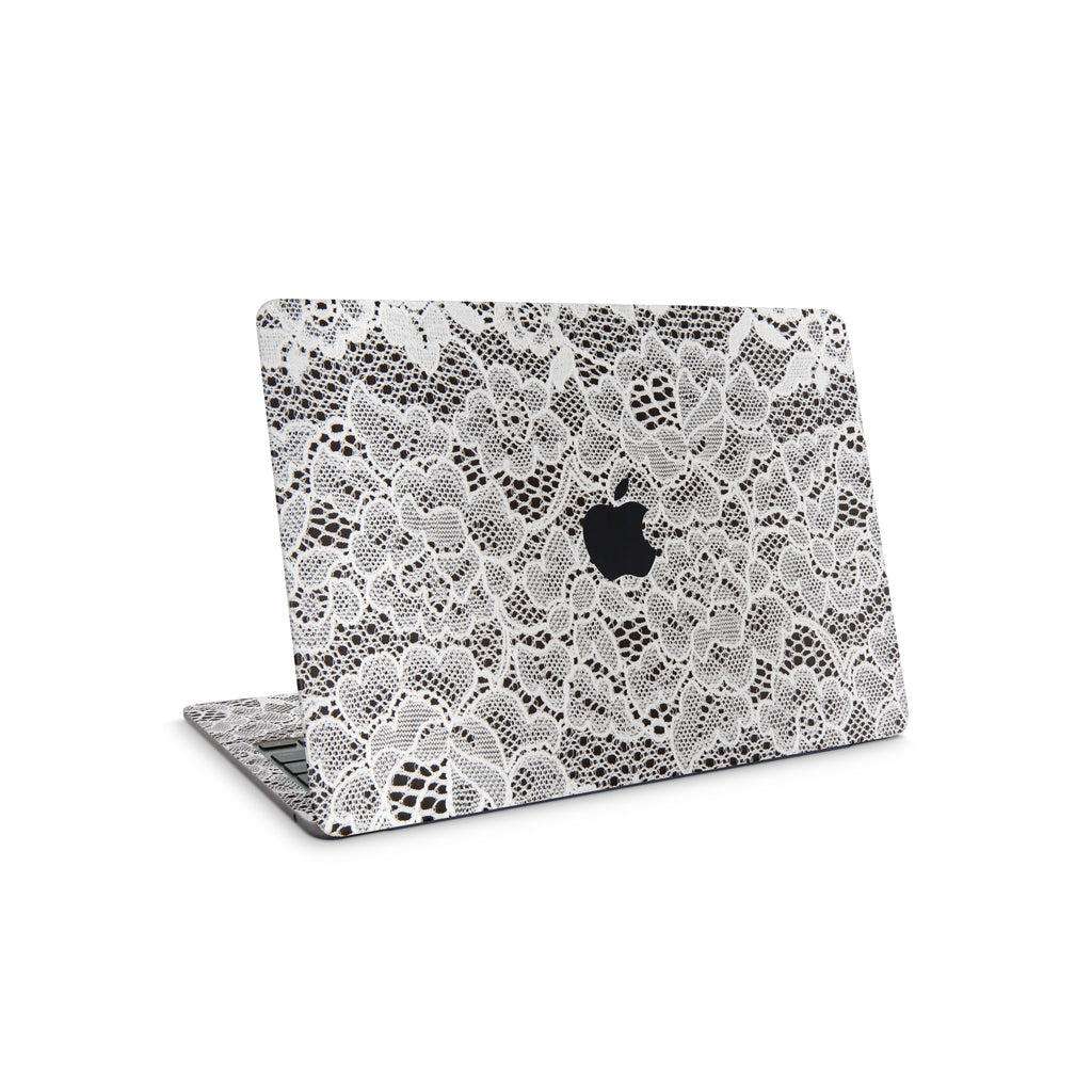 French Lace MacBook Skin + Case