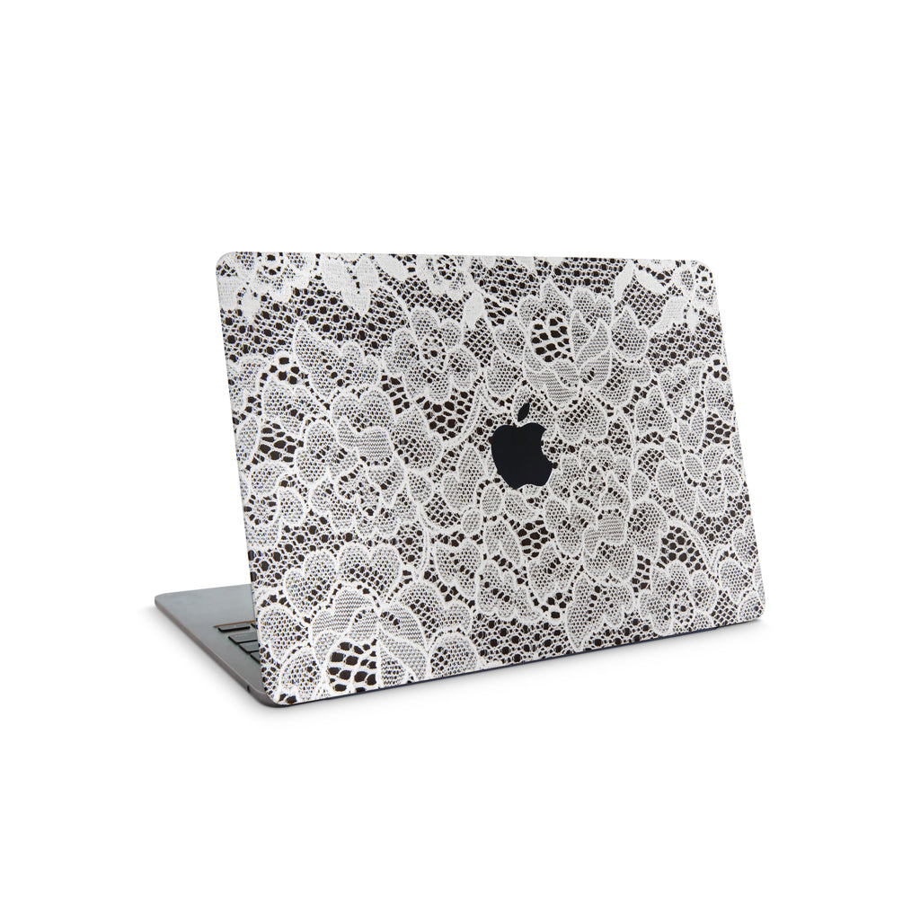 French Lace MacBook Skin + Case