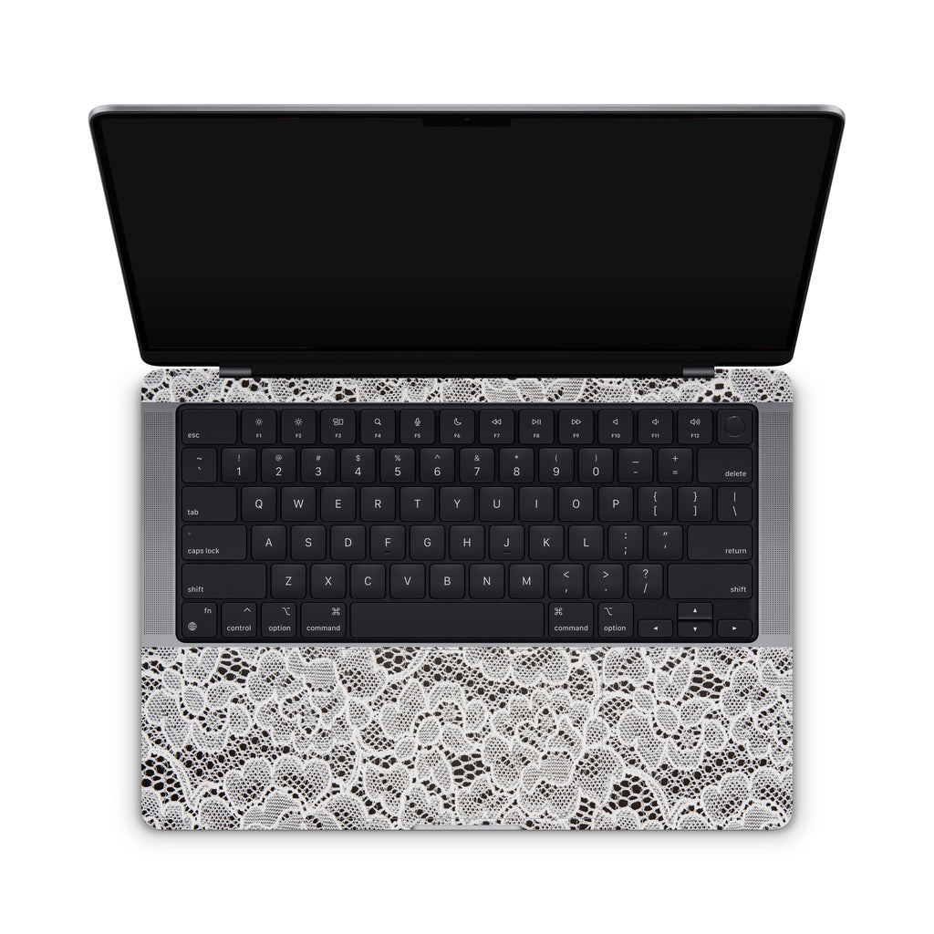 French Lace MacBook Skin + Case