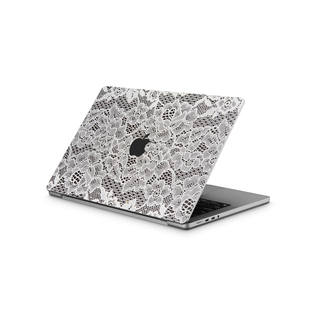 French Lace MacBook Skin + Case