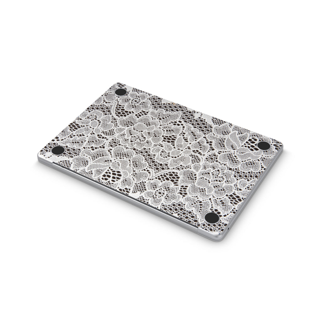 French Lace MacBook Skin + Case