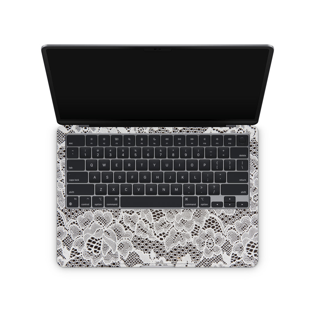 French Lace MacBook Skin + Case