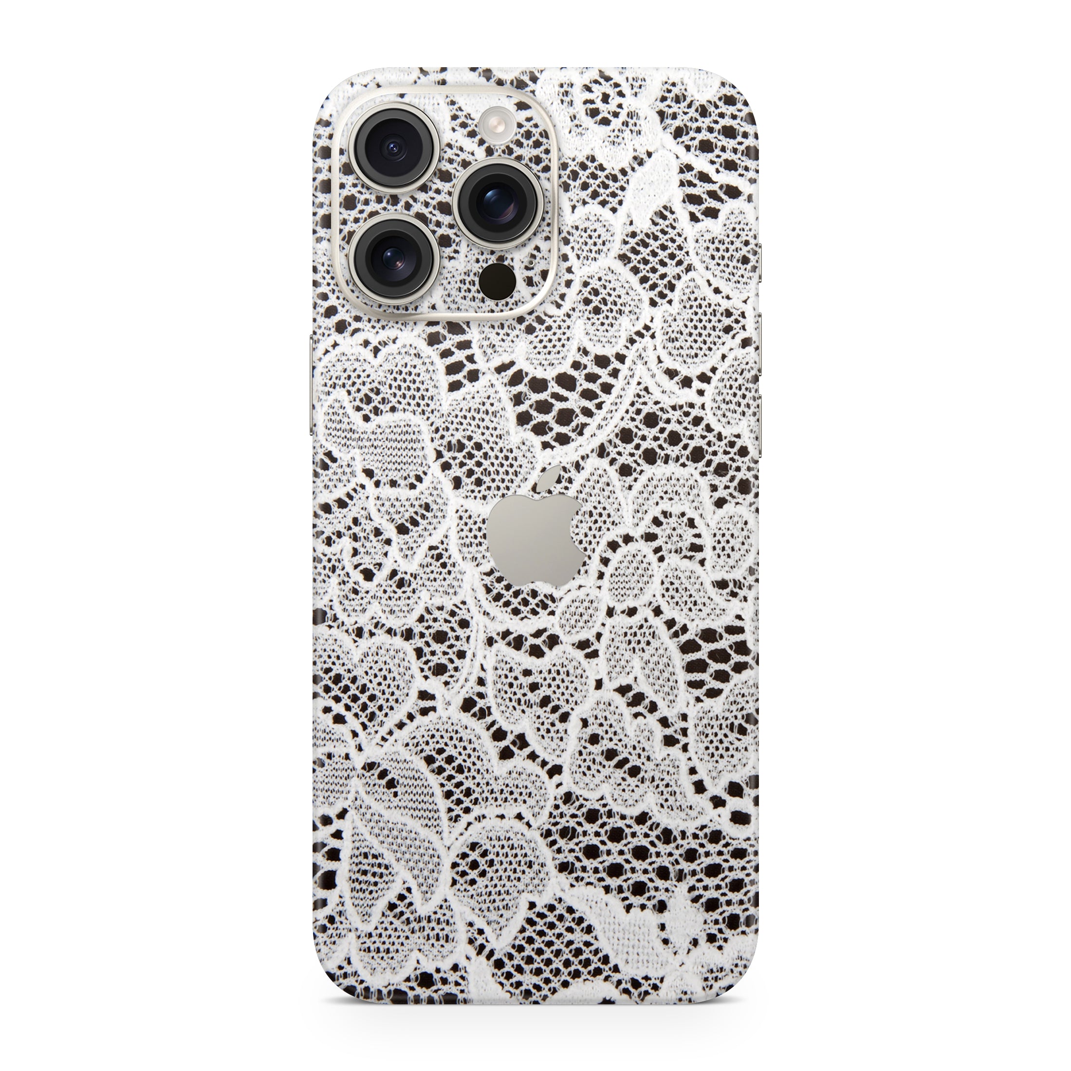 French Lace iPhone Skin + Case
