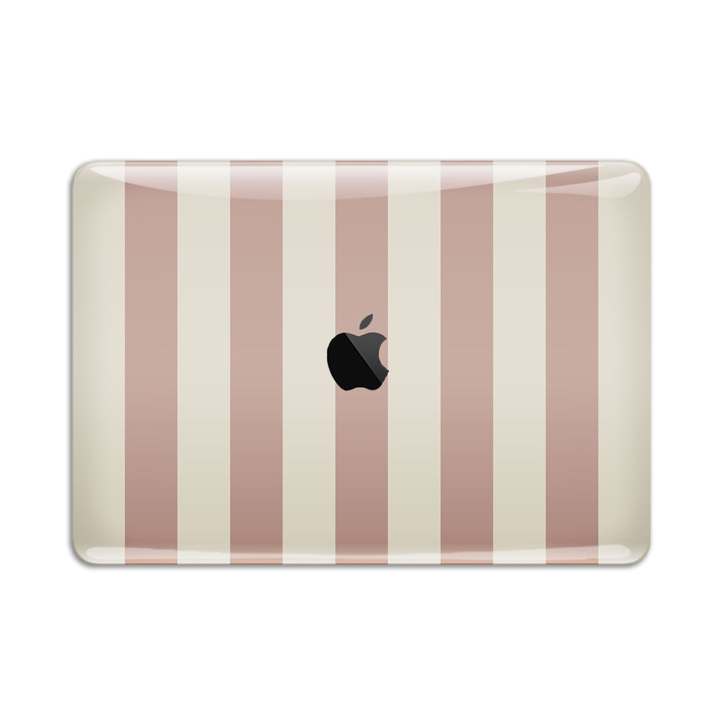 Sugar Stripe MacBook Skin + Case